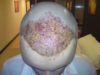 index.php/fa/12023/0/