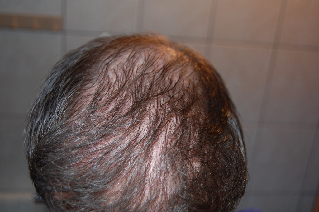 index.php/fa/12073/0/