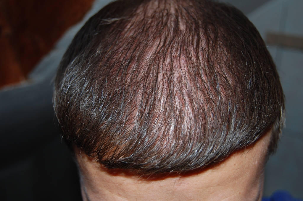 index.php/fa/12076/0/