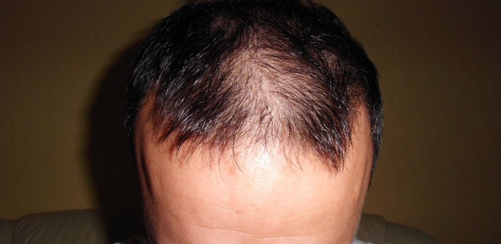 index.php/fa/12124/0/