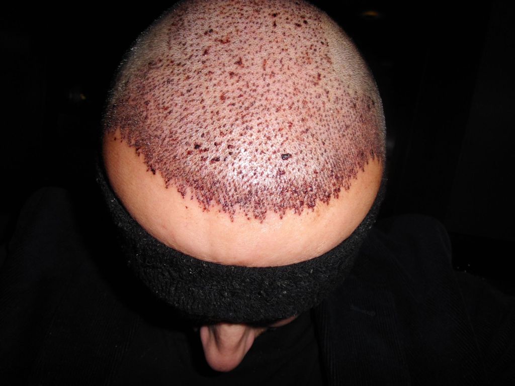 index.php/fa/12125/0/