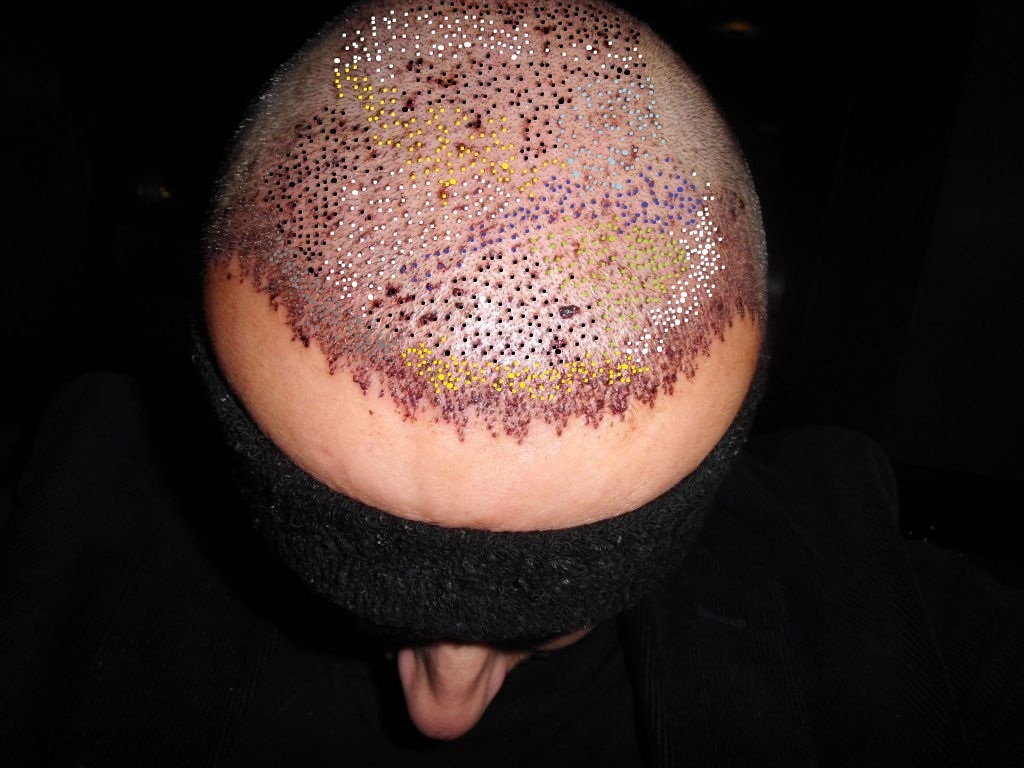 index.php/fa/12132/0/