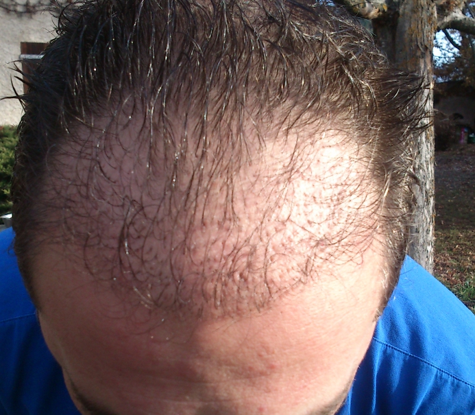 index.php/fa/12143/0/