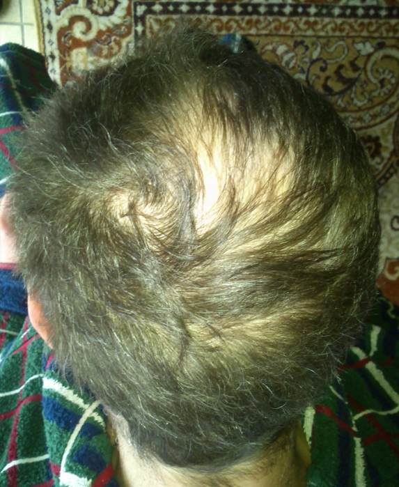 index.php/fa/12146/0/