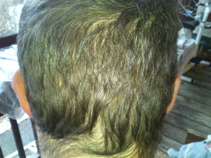 index.php/fa/12179/0/