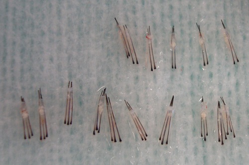 index.php/fa/12287/0/