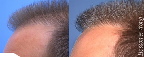 index.php/fa/12414/0/