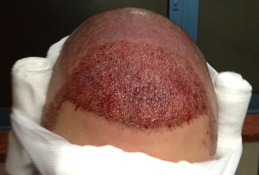 index.php/fa/12494/0/