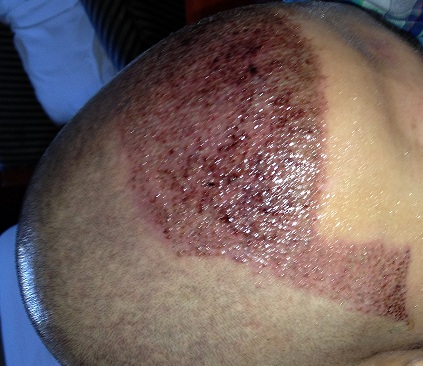 index.php/fa/12495/0/