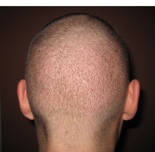 index.php/fa/12500/0/