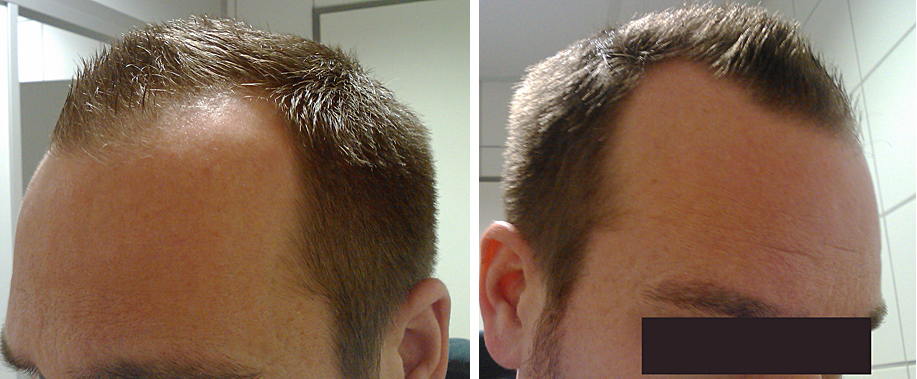 index.php/fa/12504/0/