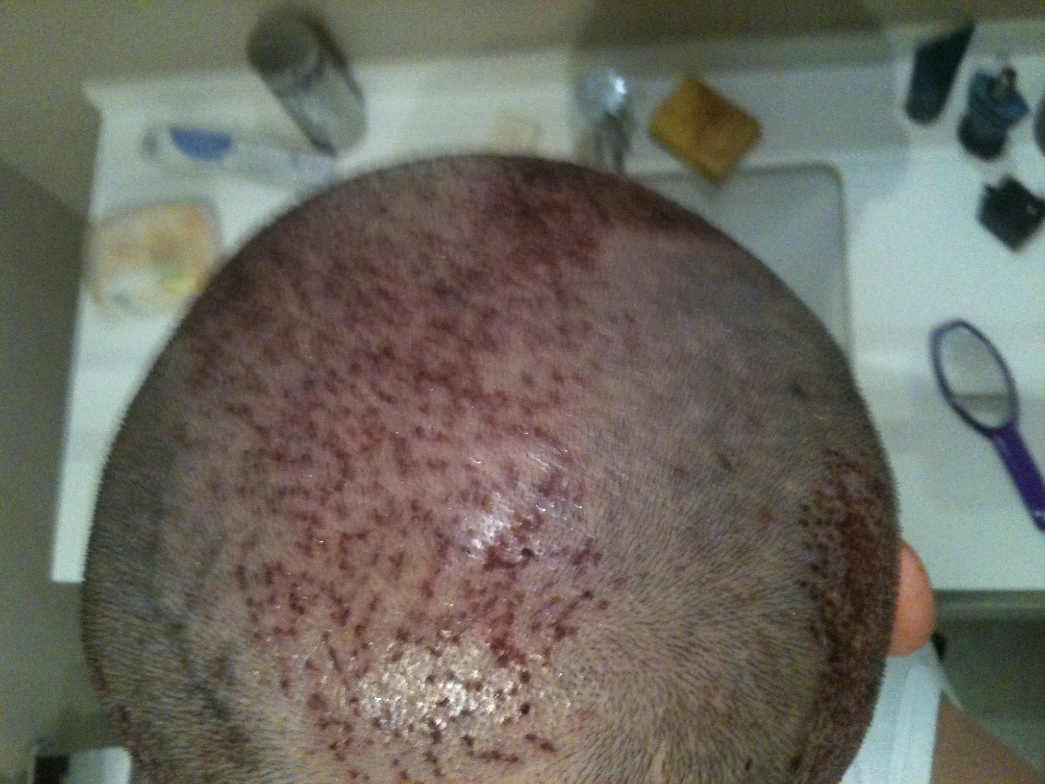 index.php/fa/12526/0/