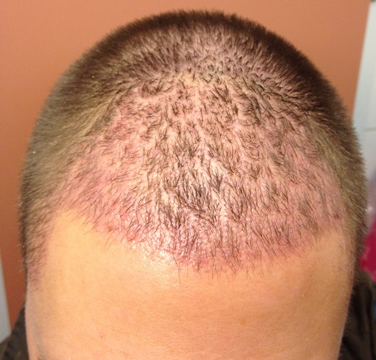 index.php/fa/12554/0/