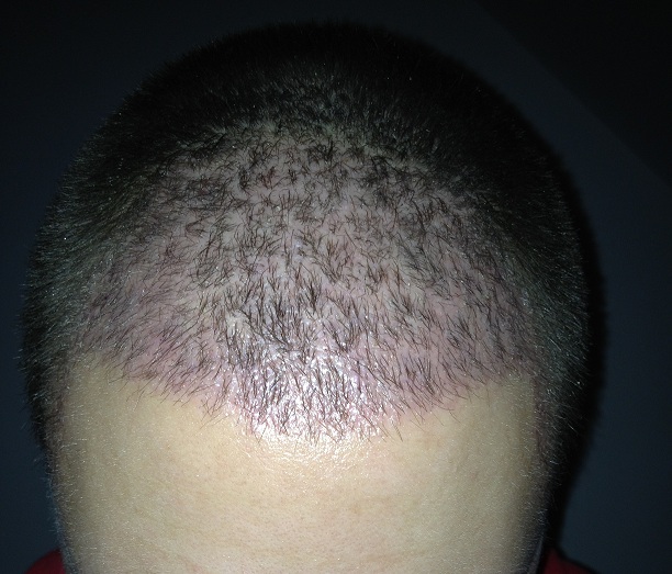 index.php/fa/12555/0/