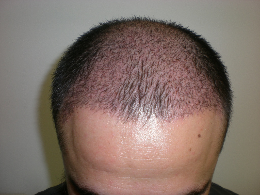 index.php/fa/12560/0/