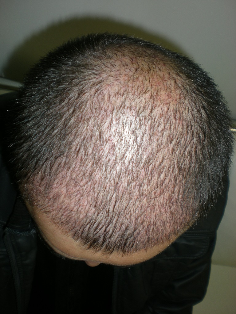 index.php/fa/12561/0/