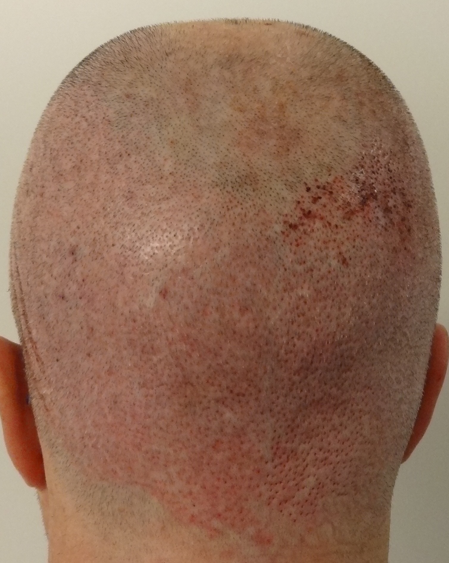 index.php/fa/12610/0/