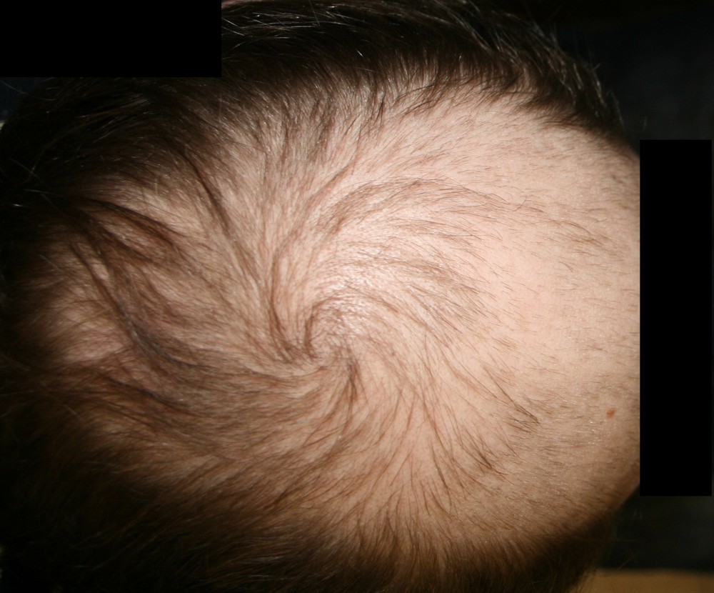 index.php/fa/12631/0/