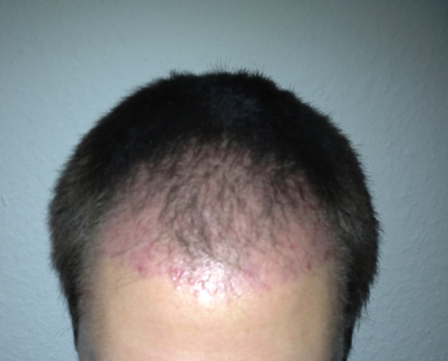 index.php/fa/12691/0/