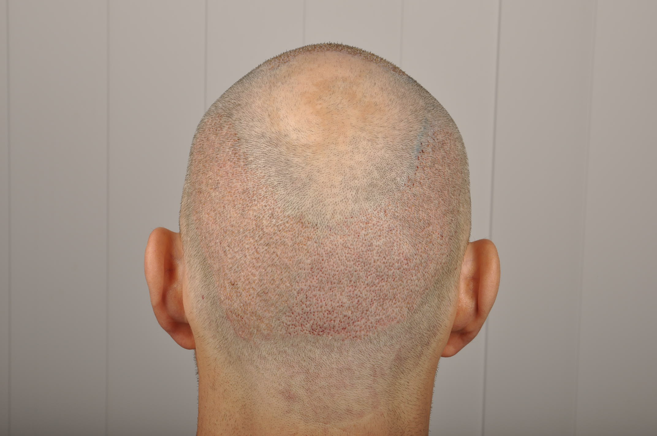 index.php/fa/12696/0/