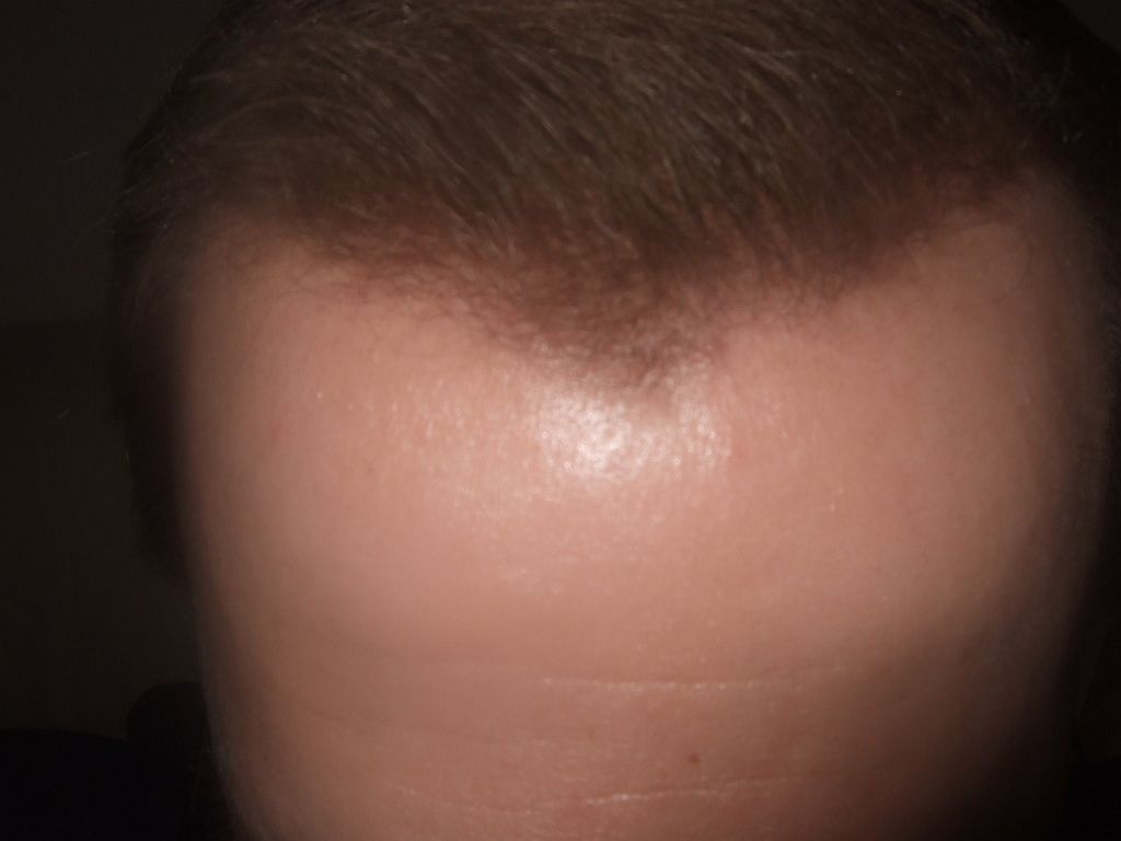 index.php/fa/1278/0/