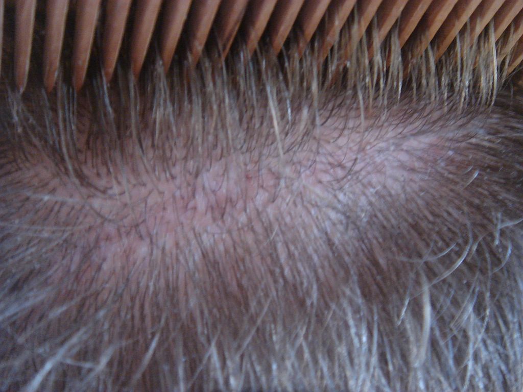 index.php/fa/1279/0/