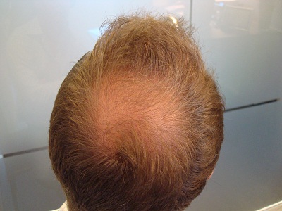 index.php/fa/13044/0/