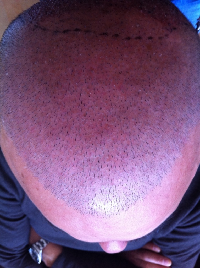 index.php/fa/13320/0/