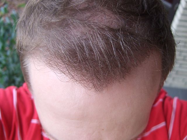 index.php/fa/1339/0/