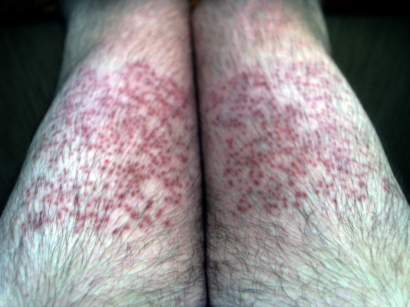 index.php/fa/13669/0/