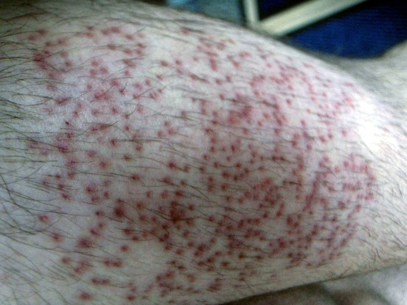 index.php/fa/13671/0/