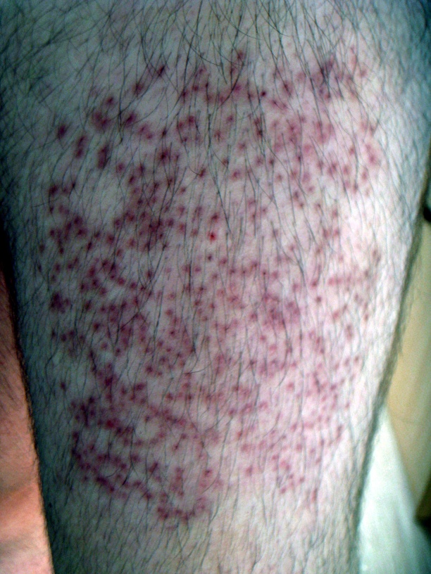 index.php/fa/13672/0/