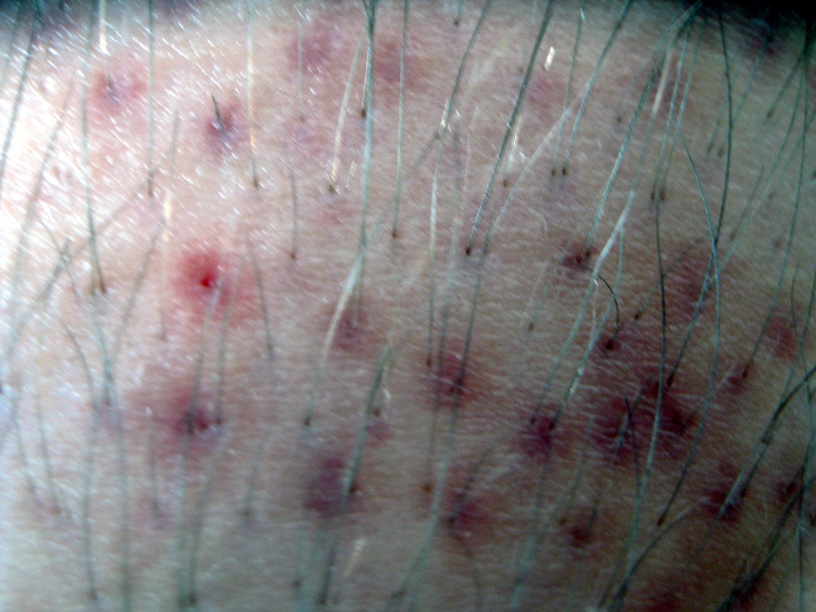 index.php/fa/13677/0/