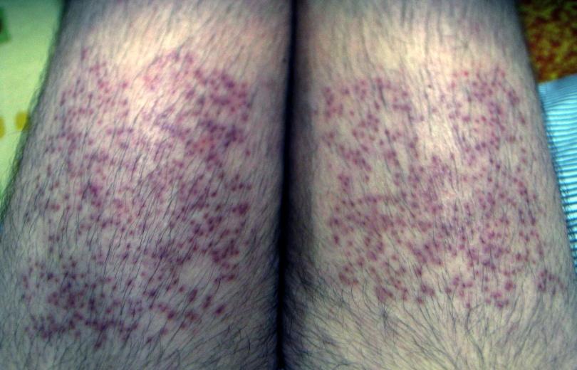 index.php/fa/13686/0/