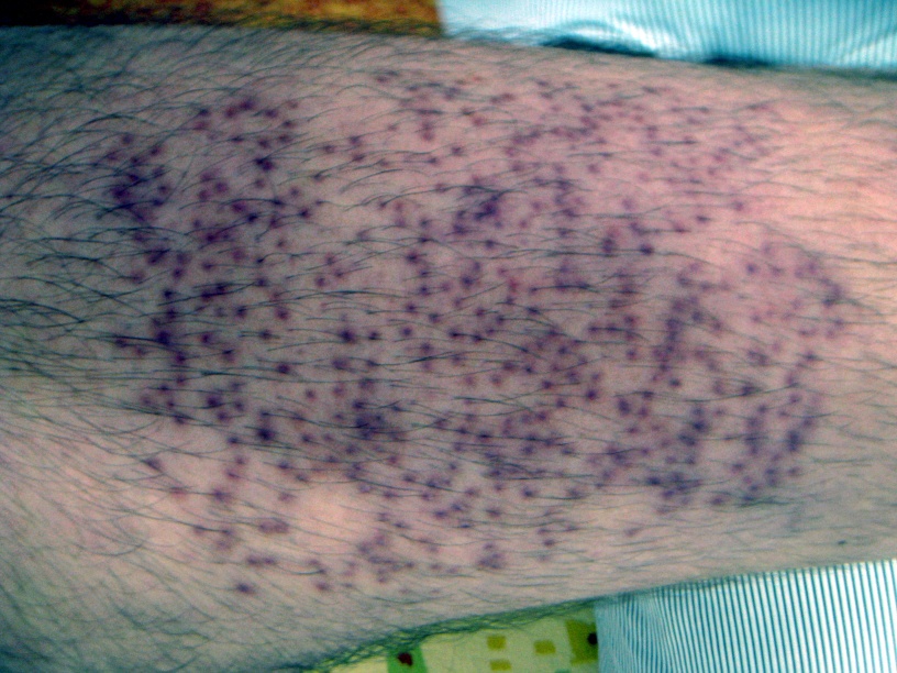 index.php/fa/13688/0/