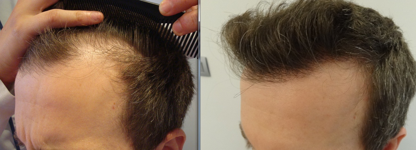 index.php/fa/13785/0/