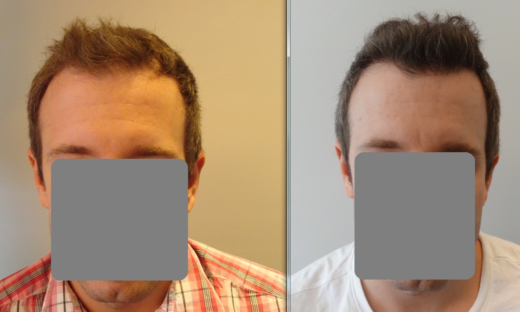 index.php/fa/13787/0/