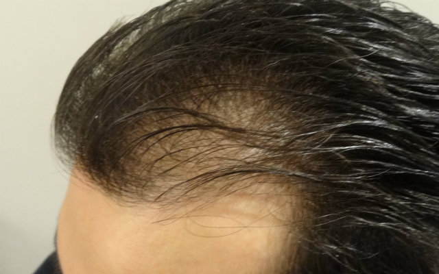 index.php/fa/13831/0/