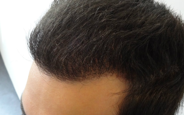 index.php/fa/13832/0/