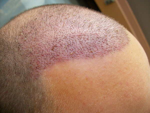 index.php/fa/13838/0/