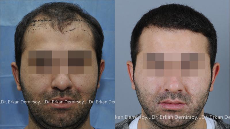 index.php/fa/13896/0/