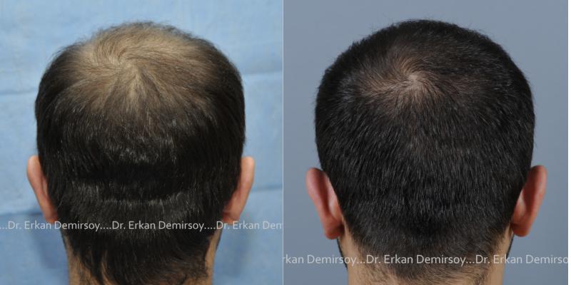 index.php/fa/13902/0/