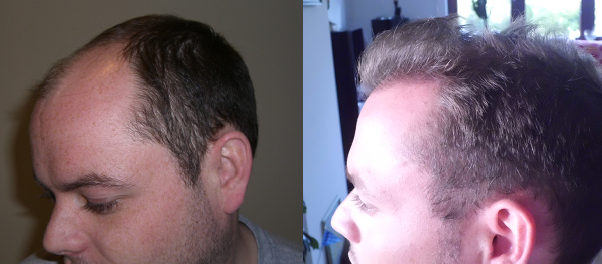 index.php/fa/14109/0/