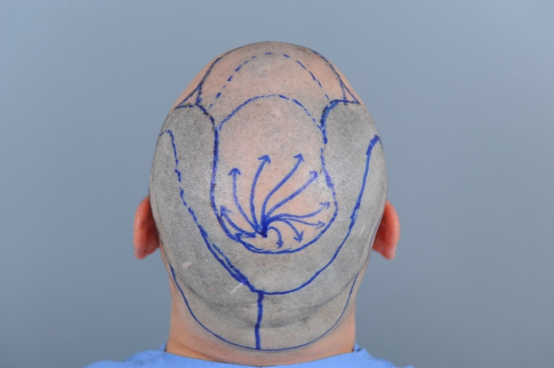 index.php/fa/14166/0/