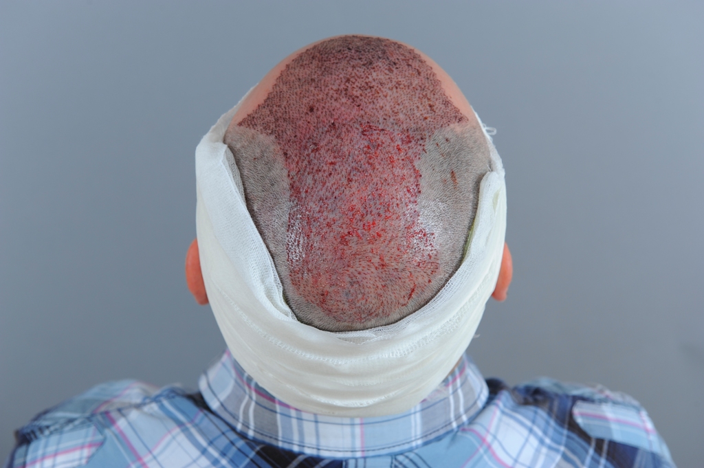 index.php/fa/14170/0/