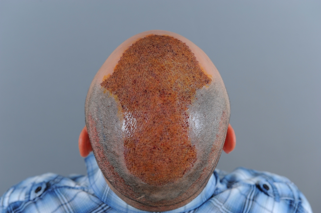 index.php/fa/14171/0/