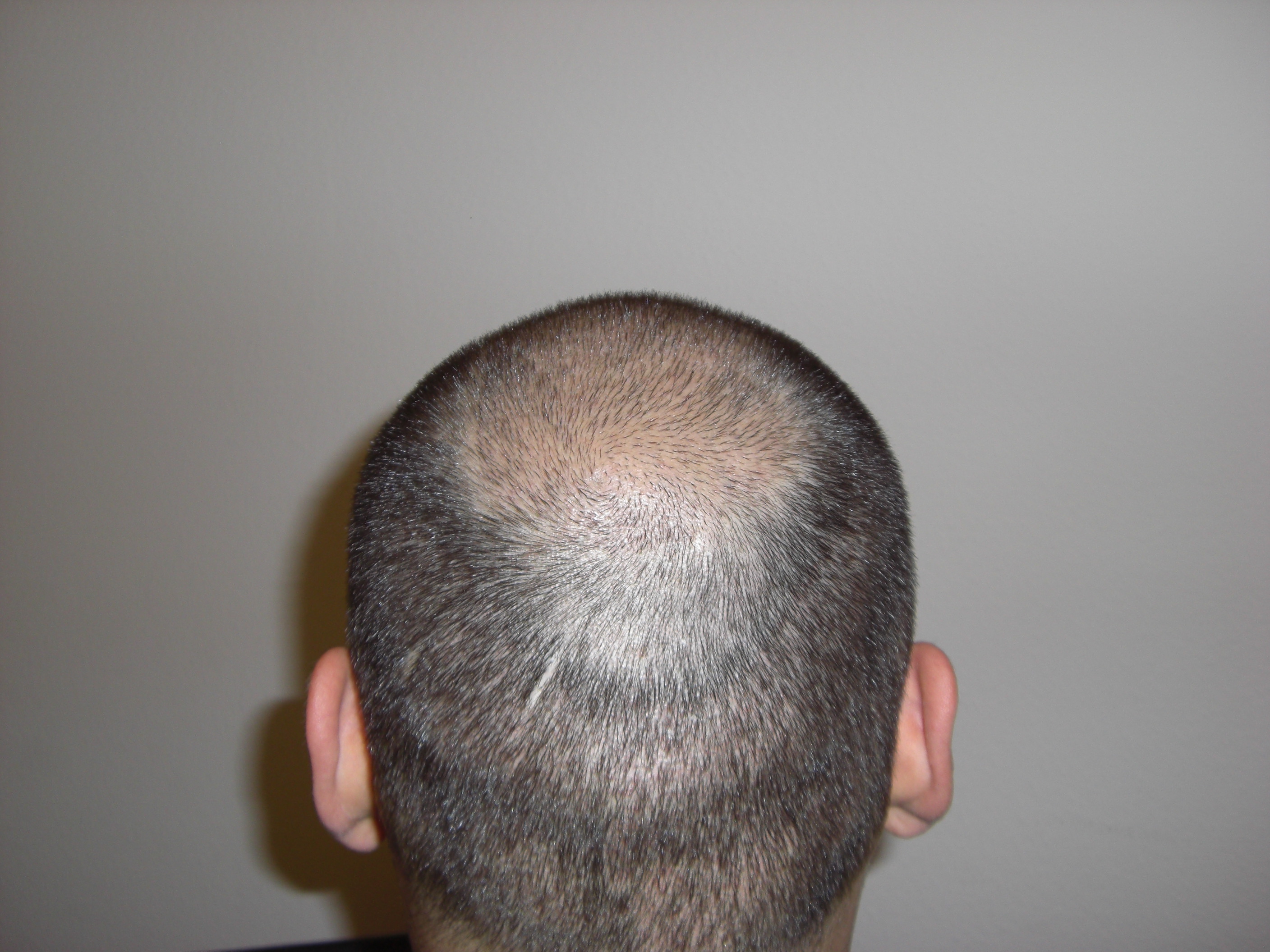 index.php/fa/14172/0/