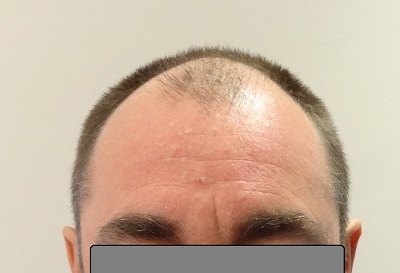 index.php/fa/14196/0/