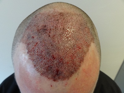 index.php/fa/14197/0/