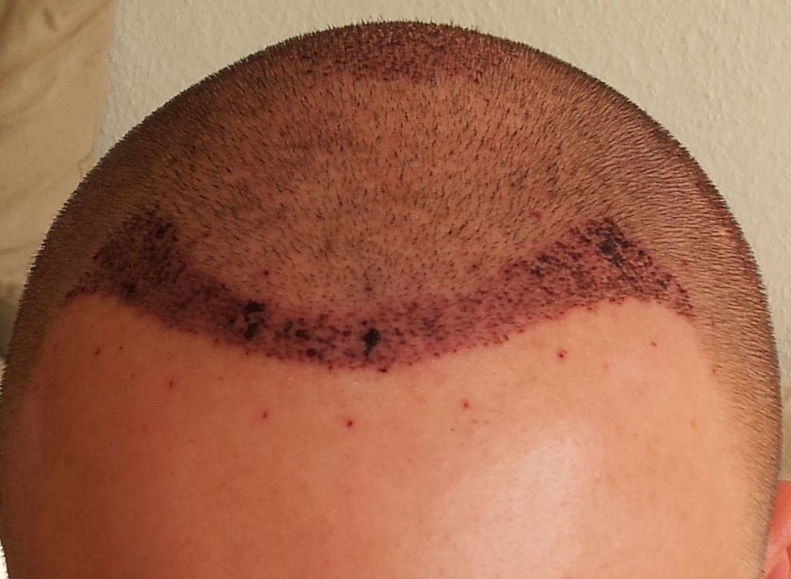 index.php/fa/14244/0/